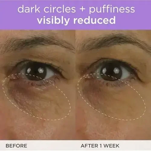 TATCHA The Brightening Eye Cream | Brightening & Dark Circle Reduction with Vitamin C for Bight, Firm Undereyes, 15 ml / 0.5 fl. oz.